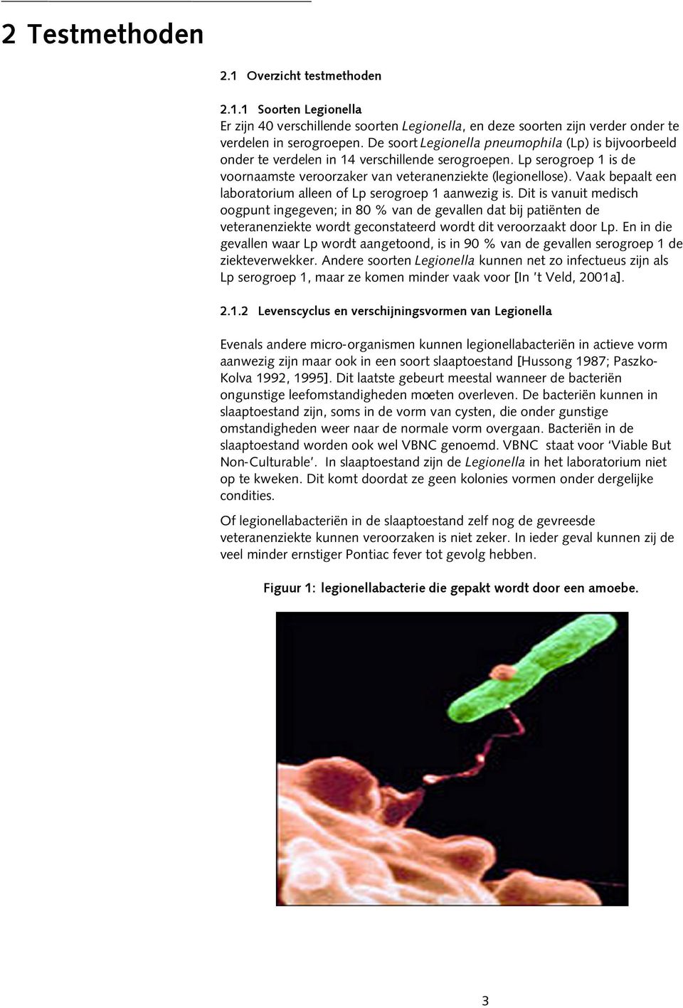 Vaak bepaalt een laboratorium alleen of Lp serogroep 1 aanwezig is.