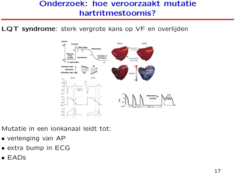 LQT syndrome: sterk vergrote kans op VF en