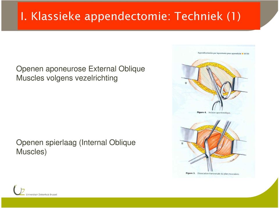 Oblique Muscles volgens vezelrichting