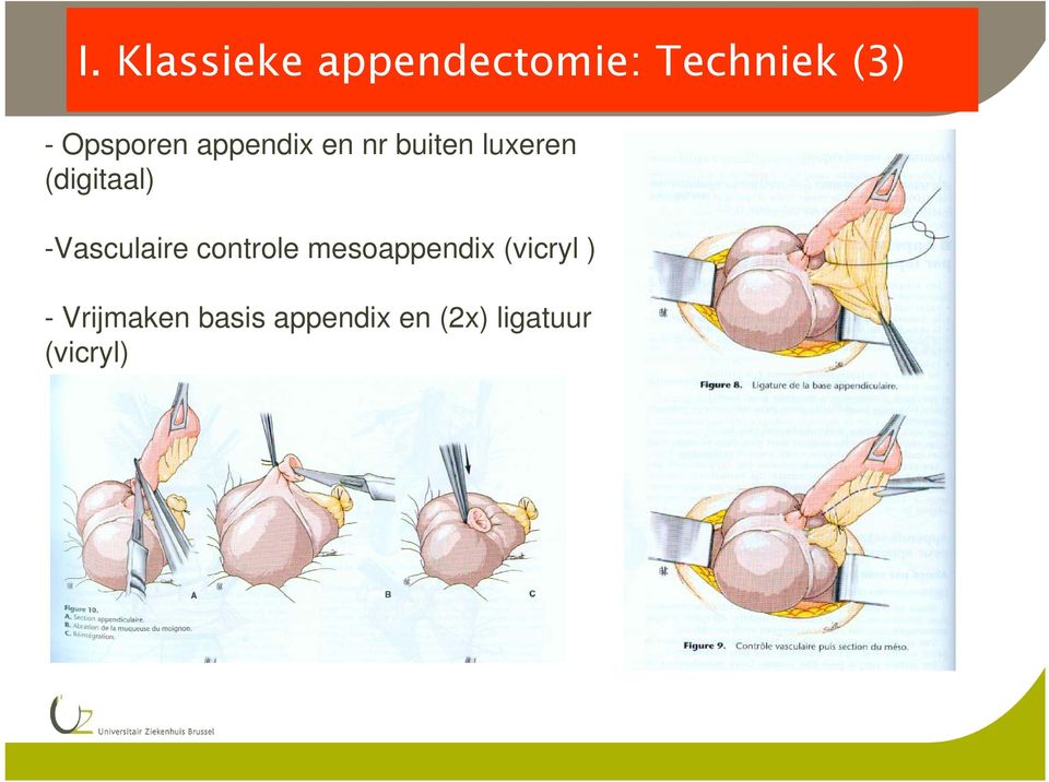 (digitaal) -Vasculaire controle mesoappendix