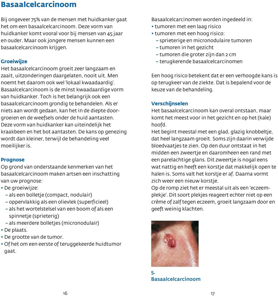 Men noemt het daarom ook wel lokaal kwaadaardig. Basaalcelcarcinoom is de minst kwaadaardige vorm van huidkanker. Toch is het belangrijk ook een basaalcelcarcinoom grondig te behandelen.