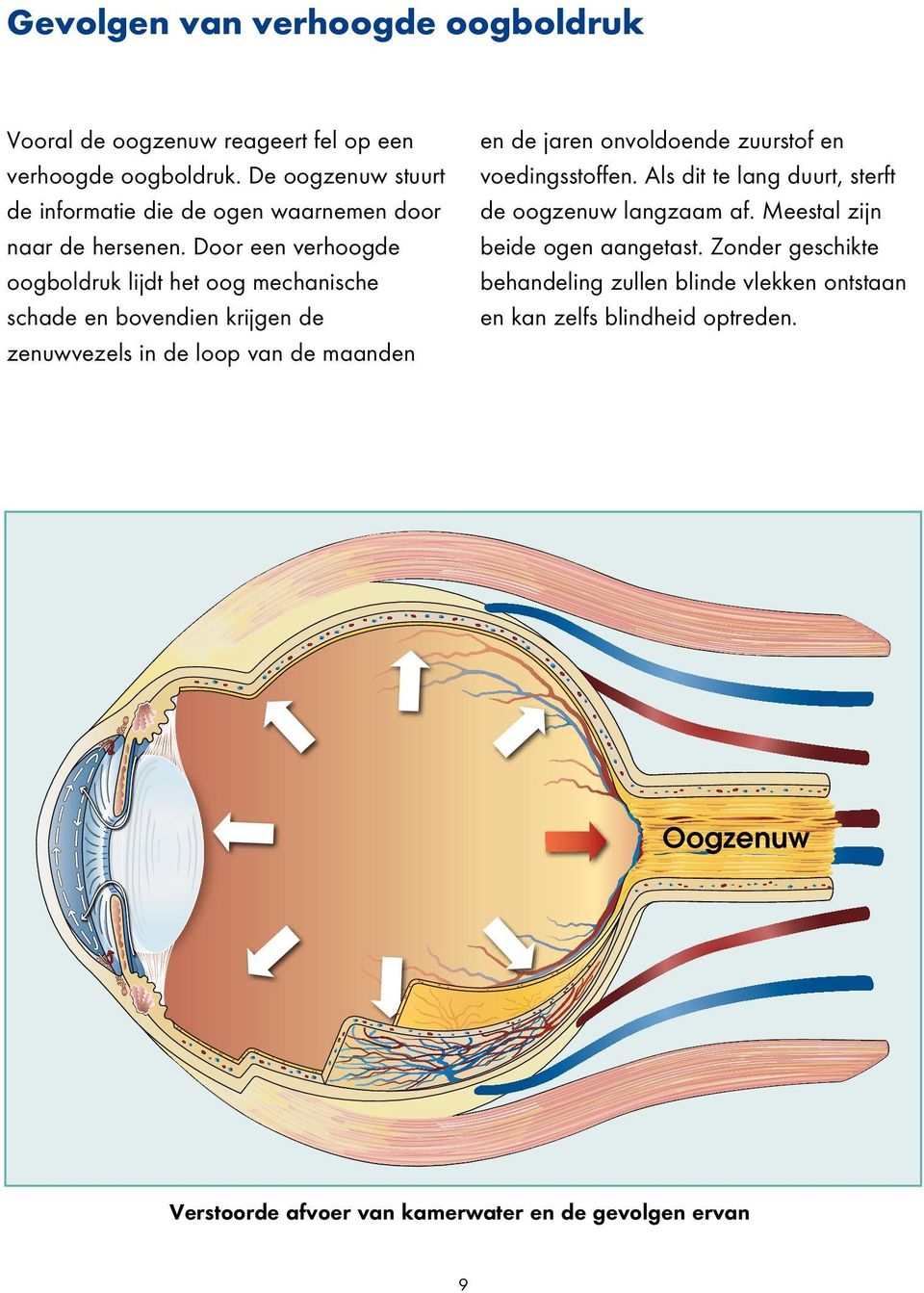 Door een verhoogde oogboldruk lijdt het oog mechanische schade en bovendien krijgen de zenuwvezels in de loop van de maanden en de jaren onvoldoende