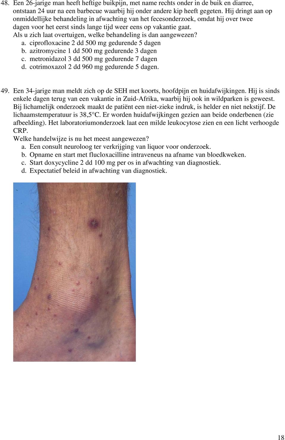 Als u zich laat overtuigen, welke behandeling is dan aangewezen? a. ciprofloxacine 2 dd 500 mg gedurende 5 dagen b. azitromycine 1 dd 500 mg gedurende 3 dagen c.