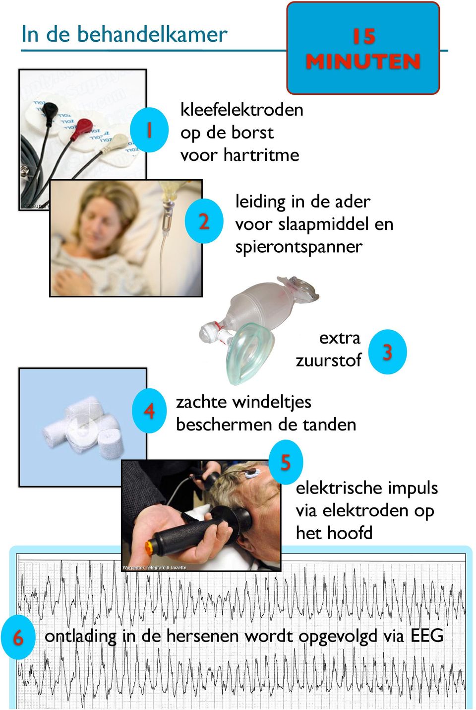 zuurstof 3 4 zachte windeltjes beschermen de tanden 5 elektrische impuls