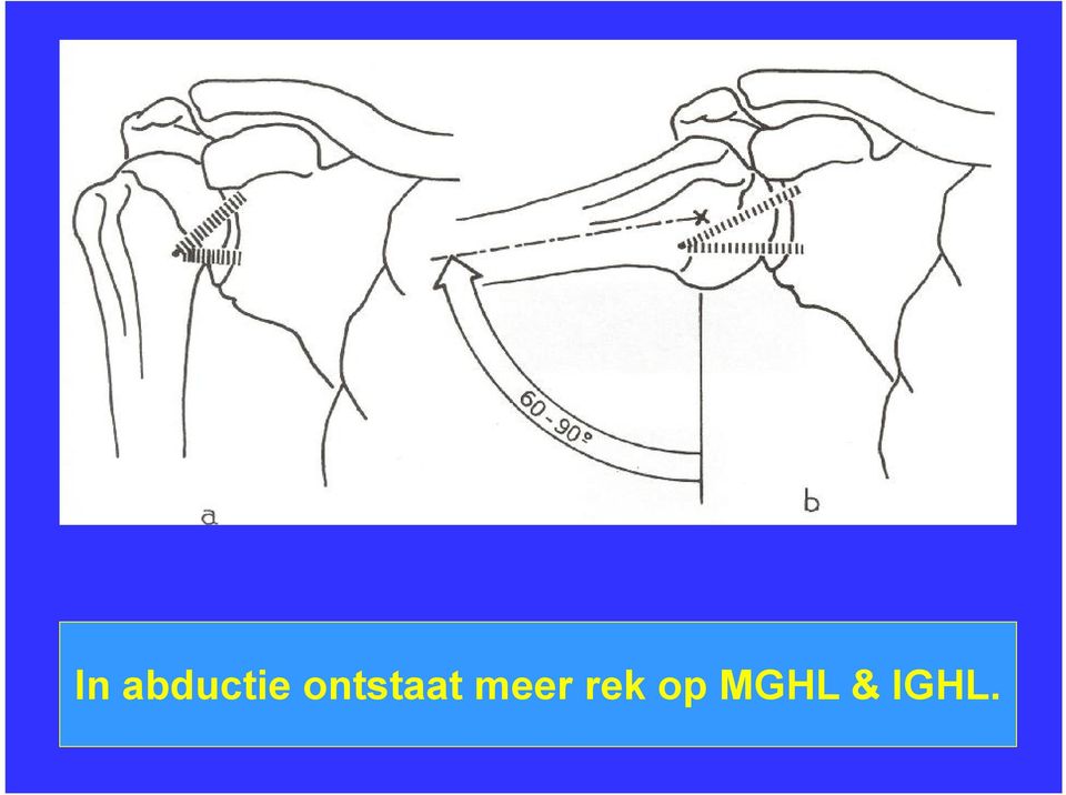 meer rek op