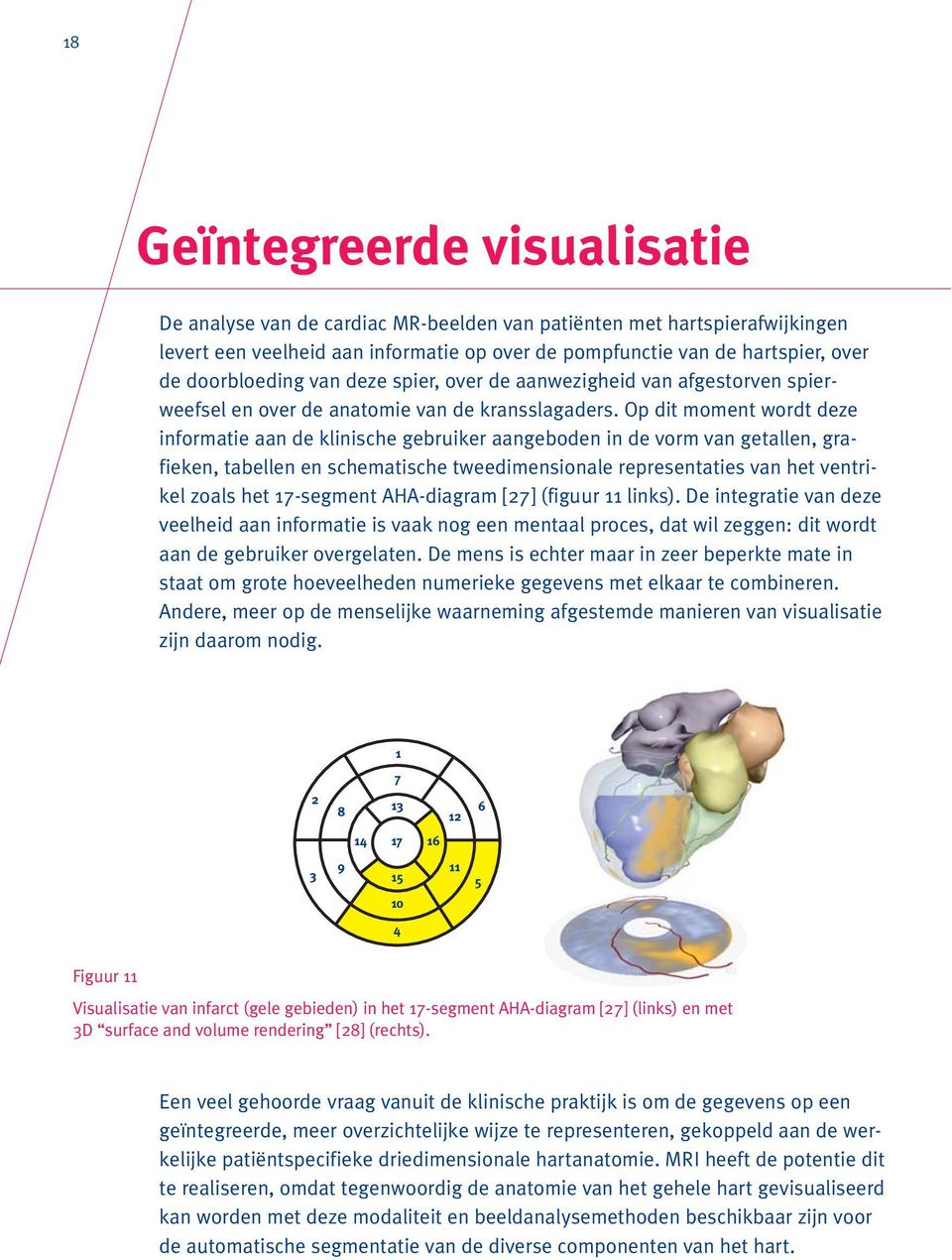 Op dit moment wordt deze informatie aan de klinische gebruiker aangeboden in de vorm van getallen, grafieken, tabellen en schematische tweedimensionale representaties van het ventrikel zoals het