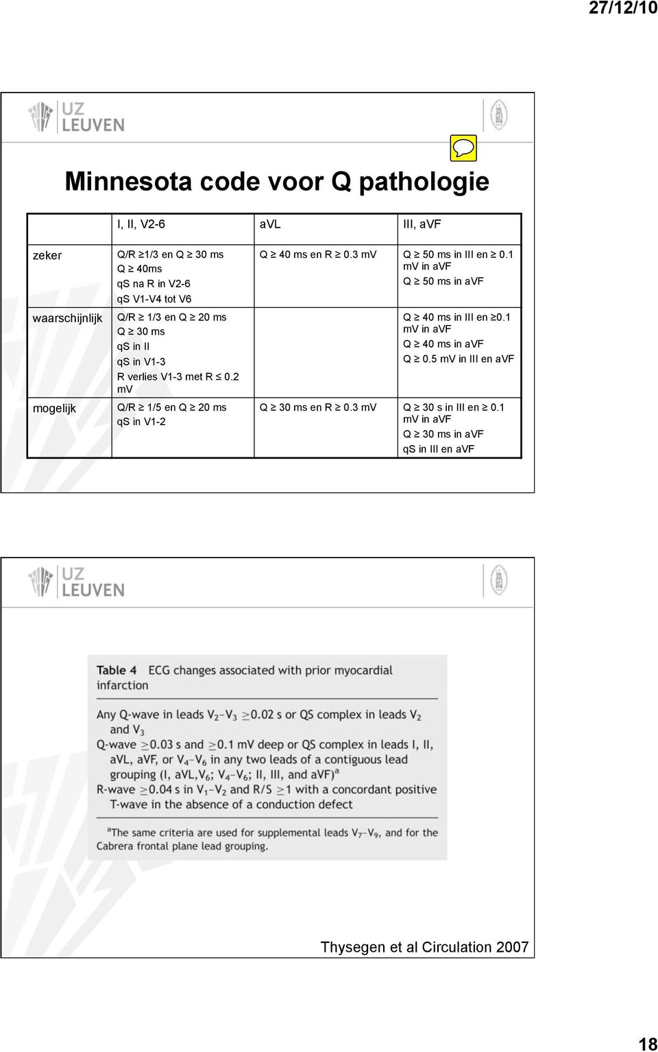 20 ms qs in V1-2 Q! 40 ms en R! 0.3 mv Q! 50 ms in III en! 0.1 mv in avf Q! 50 ms in avf Q! 40 ms in III en!0.1 mv in avf Q! 40 ms in avf Q!