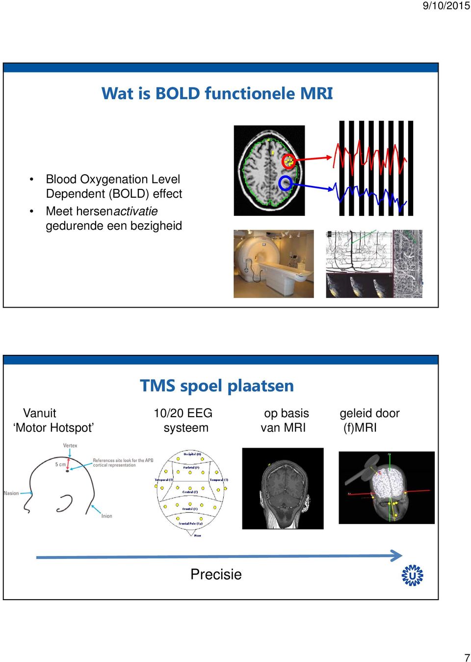 een bezigheid TMS spoel plaatsen Vanuit 10/20 EEG op