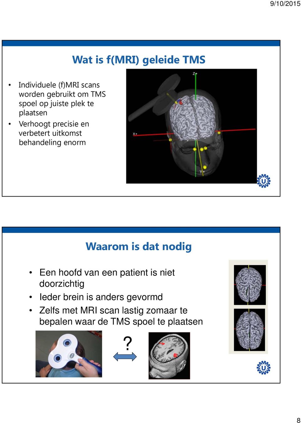 Waarom is dat nodig Een hoofd van een patient is niet doorzichtig Ieder brein is