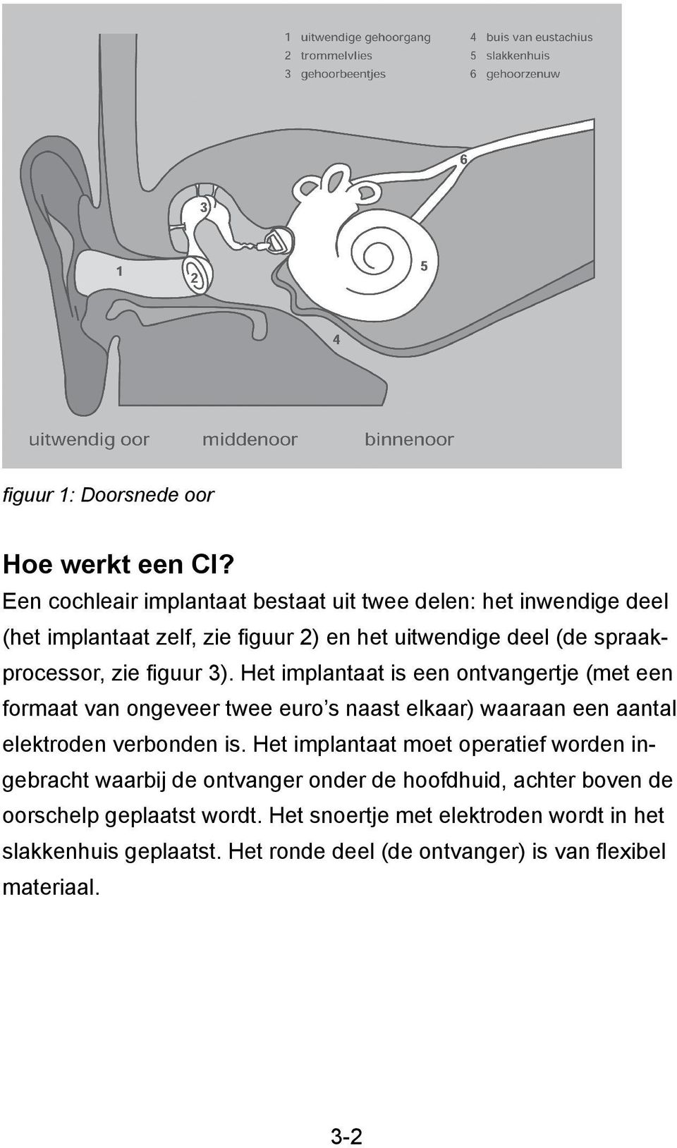 zie figuur 3). Het implantaat is een ontvangertje (met een formaat van ongeveer twee euro s naast elkaar) waaraan een aantal elektroden verbonden is.