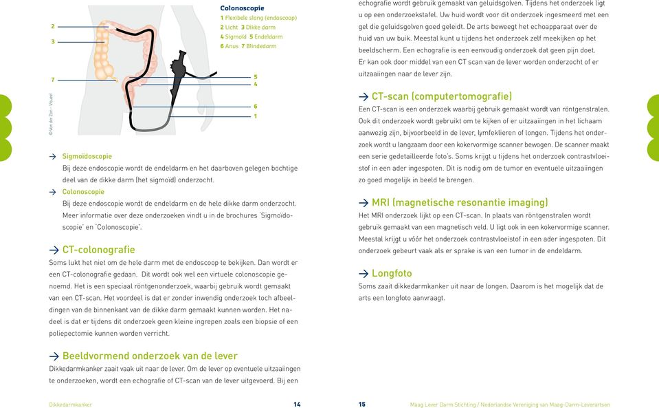 CT-colonografie Colonoscopie 1 Flexibele slang (endoscoop) 2 Licht 3 Dikke darm 4 Sigmoïd 5 Endeldarm 6 Anus 7 Blindedarm Soms lukt het niet om de hele darm met de endoscoop te bekijken.