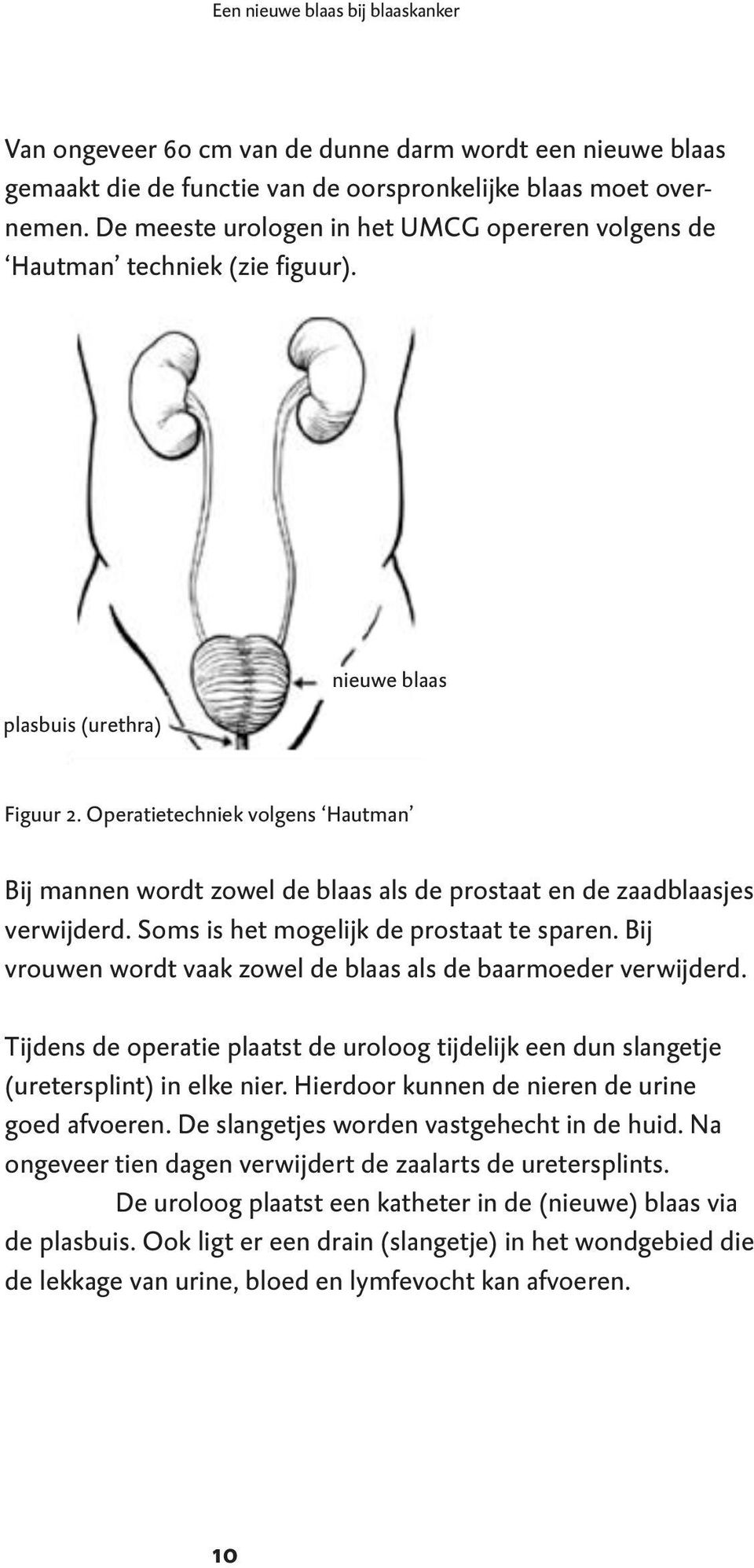 Operatietechniek volgens Hautman Bij mannen wordt zowel de blaas als de prostaat en de zaadblaasjes verwijderd. Soms is het mogelijk de prostaat te sparen.