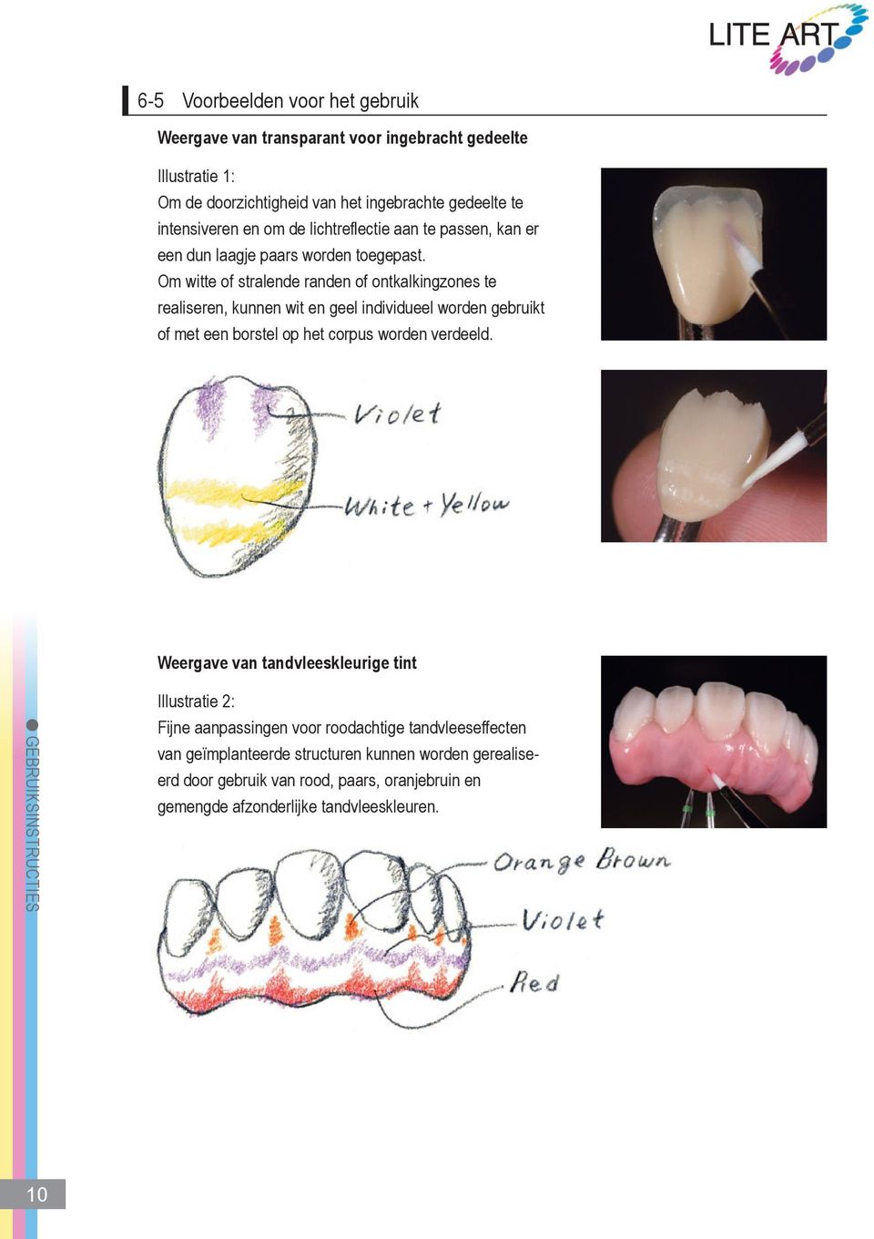 Om witte of stralende randen of ontkalkingzones te realiseren, kunnen wit en geel individueel worden gebruikt of met een borstel op het corpus worden verdeeld.