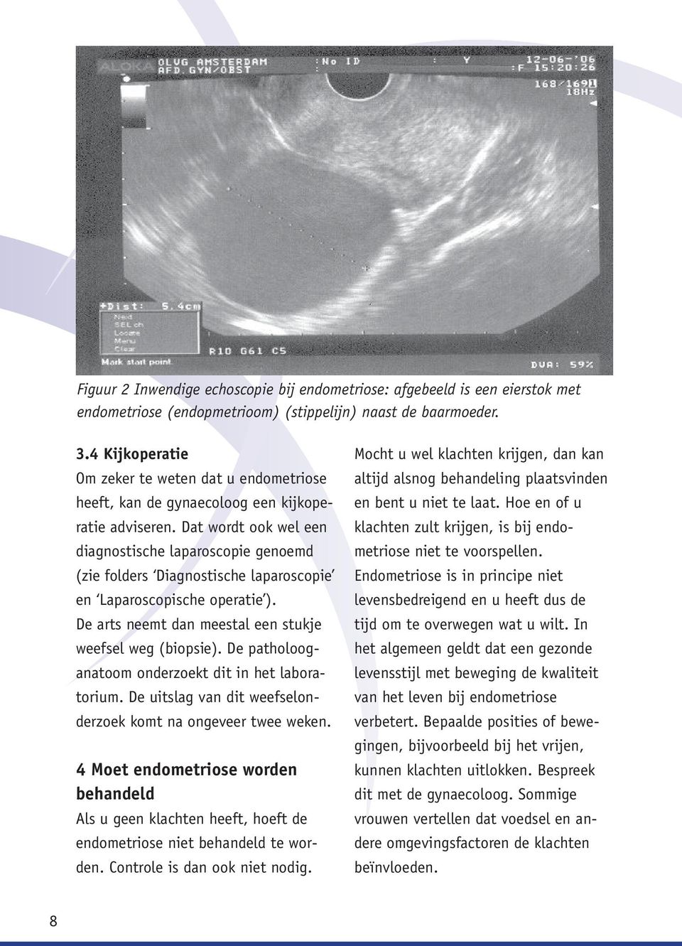 Dat wordt ook wel een diagnostische laparoscopie genoemd (zie folders Diagnostische laparoscopie en Laparoscopische operatie ). De arts neemt dan meestal een stukje weefsel weg (biopsie).