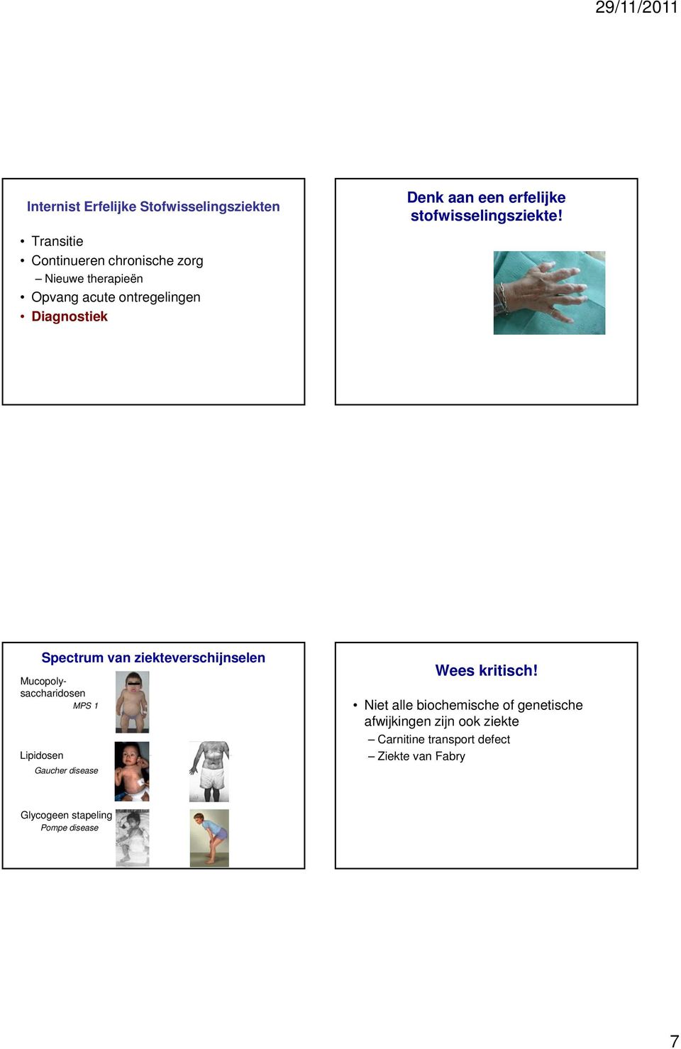 Spectrum van ziekteverschijnselen Mucopolysaccharidosen MPS 1 Lipidosen Gaucher disease Wees kritisch!