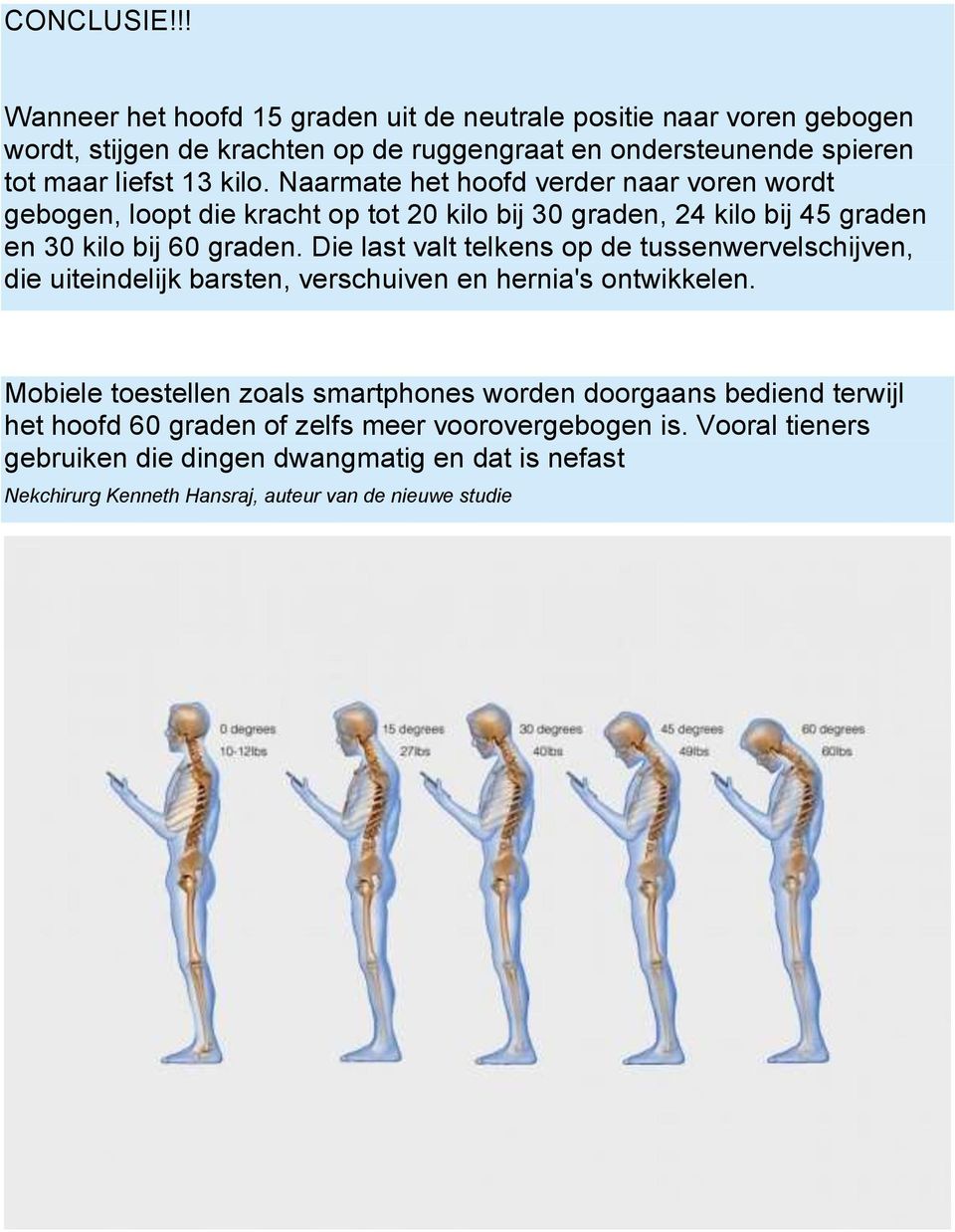 Naarmate het hoofd verder naar voren wordt gebogen, loopt die kracht op tot 20 kilo bij 30 graden, 24 kilo bij 45 graden en 30 kilo bij 60 graden.