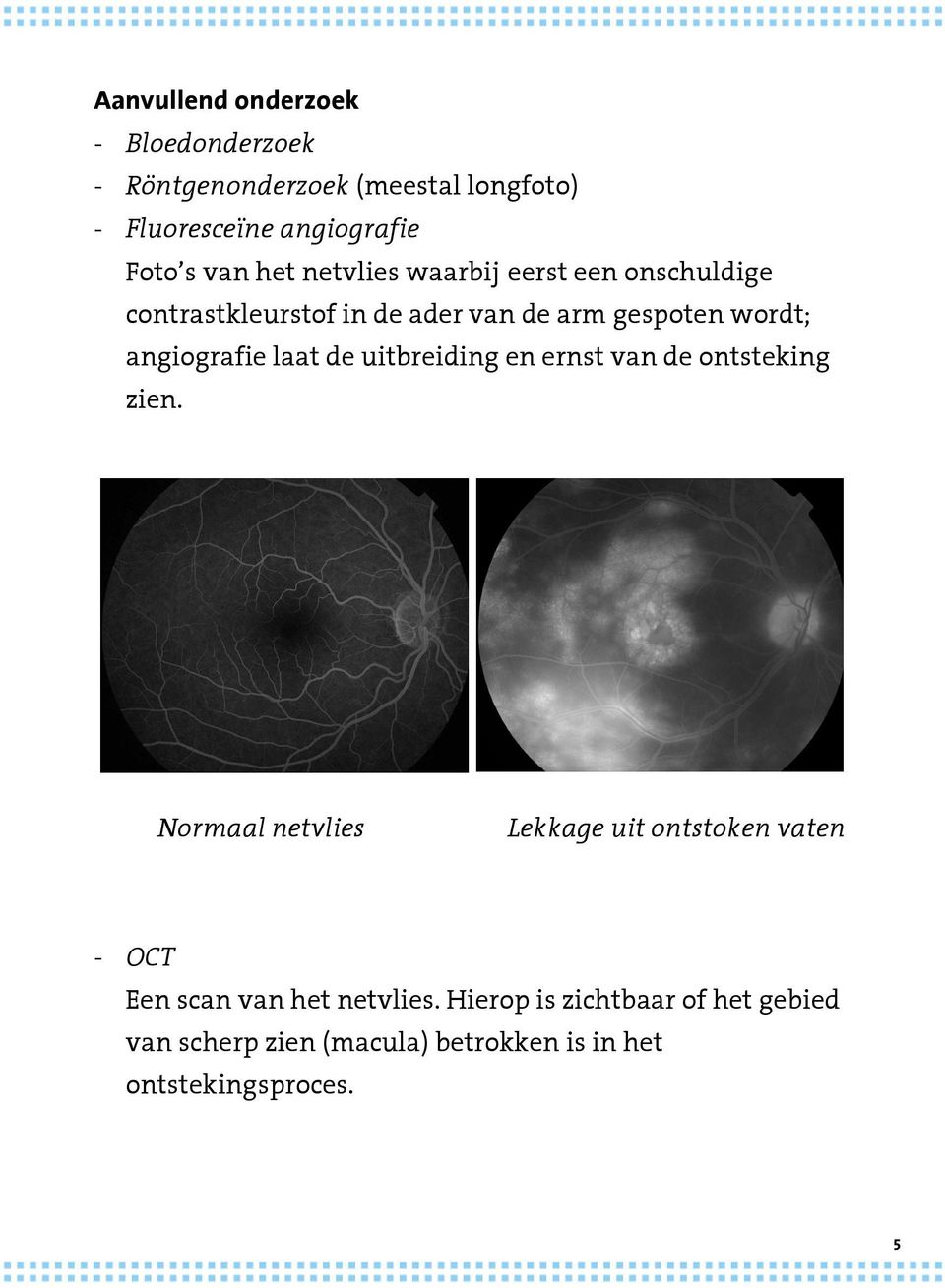 laat de uitbreiding en ernst van de ontsteking zien.