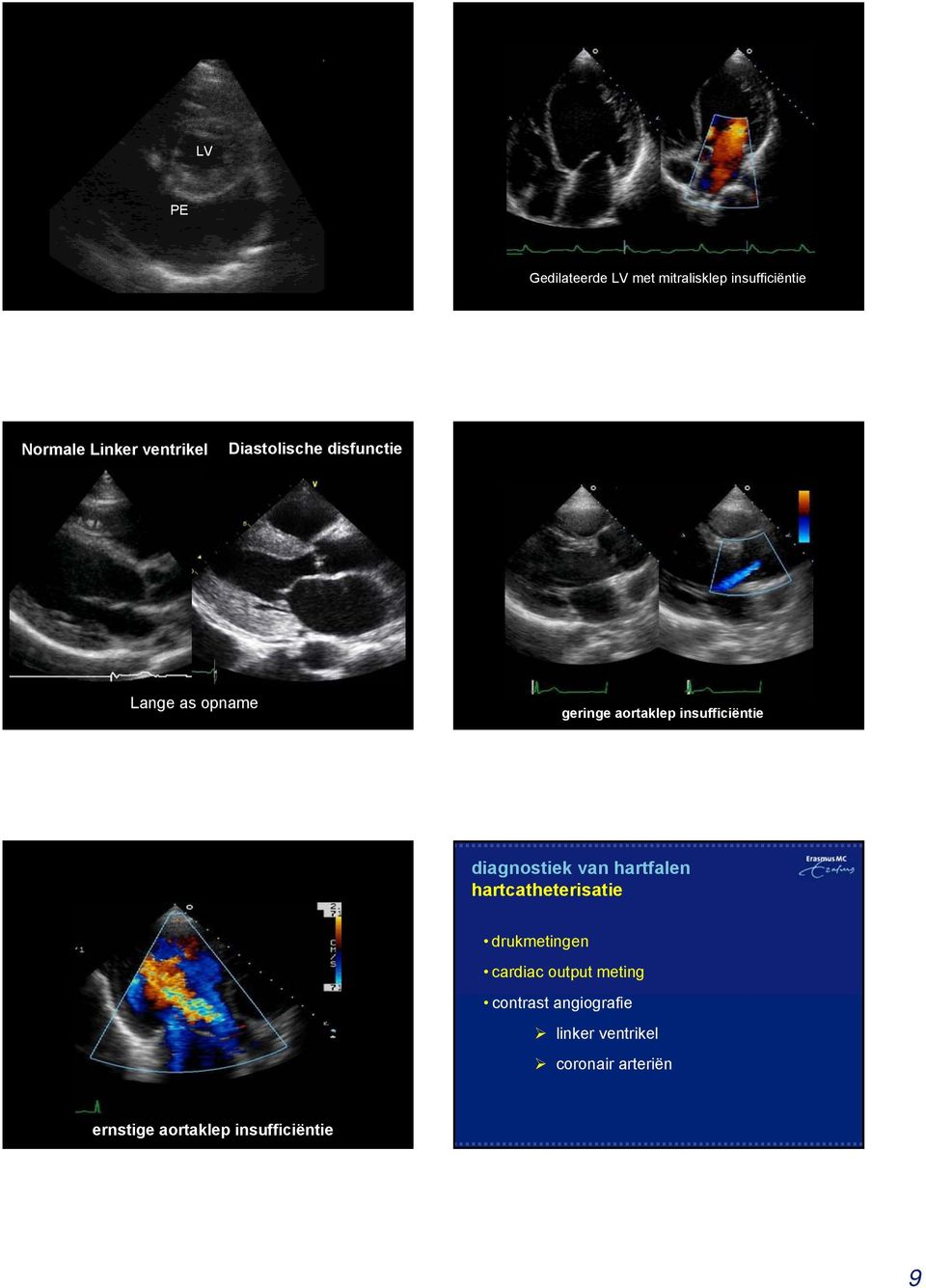 diagnostiek van hartfalen hartcatheterisatie drukmetingen cardiac output meting