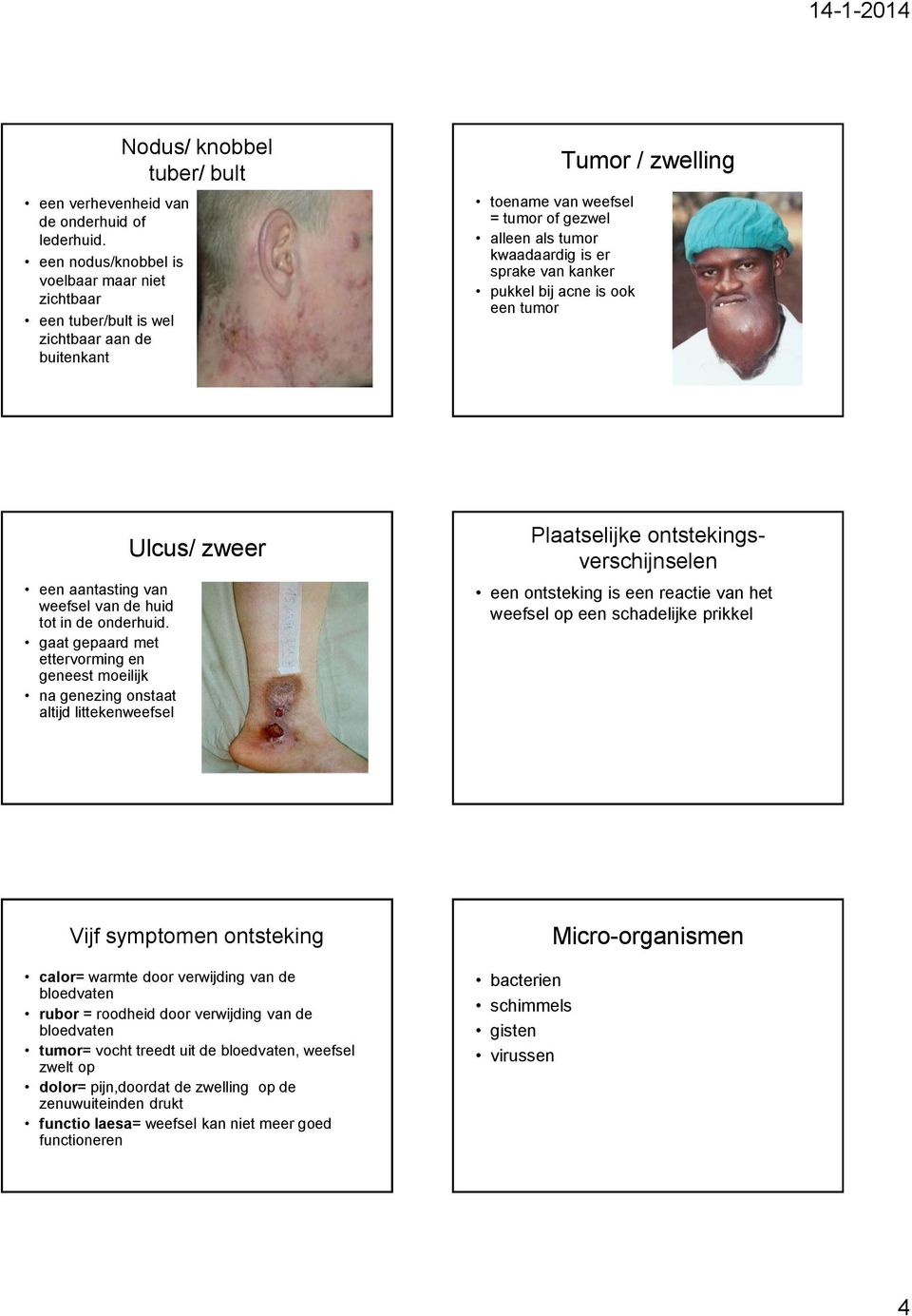 sprake van kanker pukkel bij acne is ook een tumor Tumor / zwelling een aantasting van weefsel van de huid tot in de onderhuid.