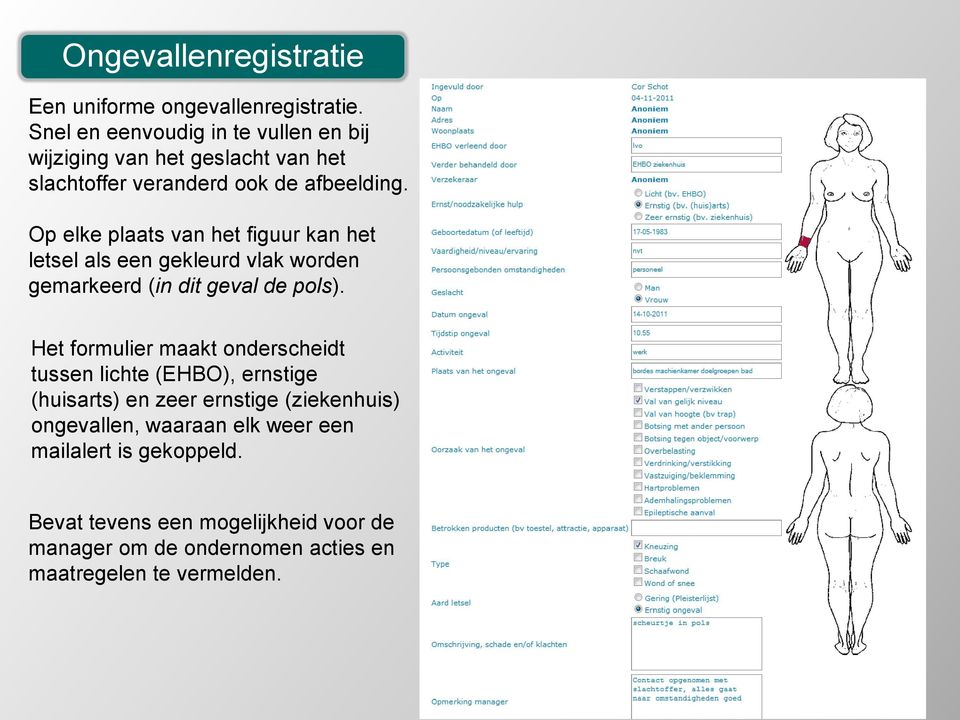 Op elke plaats van het figuur kan het letsel als een gekleurd vlak worden gemarkeerd (in dit geval de pols).