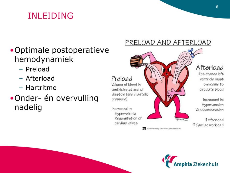 hemodynamiek Preload