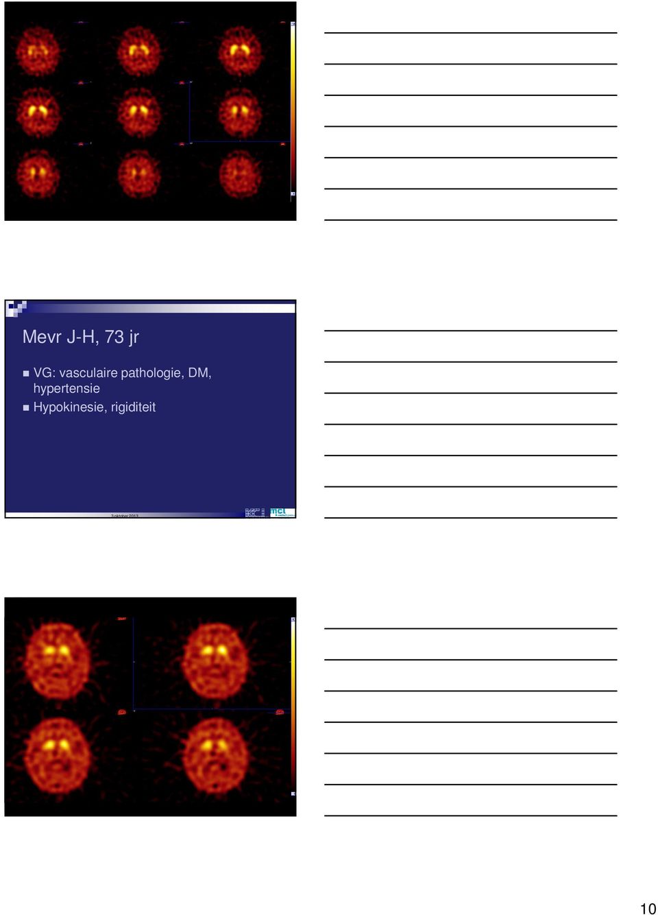 pathologie, DM,