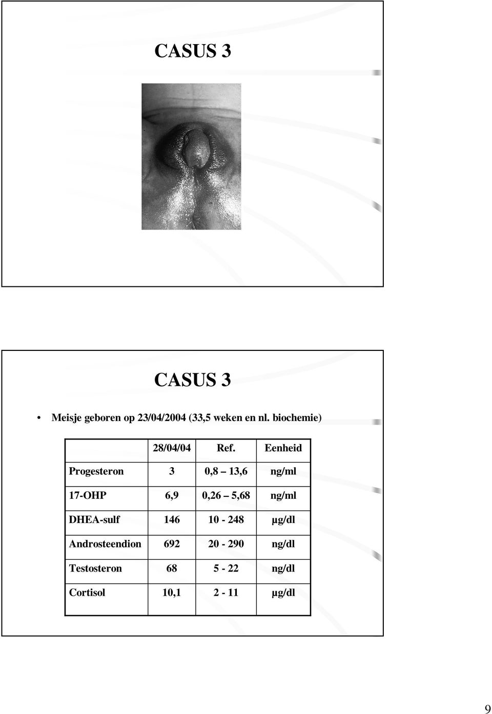 Eenheid Progesteron 3 0,8 13,6 ng/ml 17-OHP 6,9 0,26 5,68 ng/ml