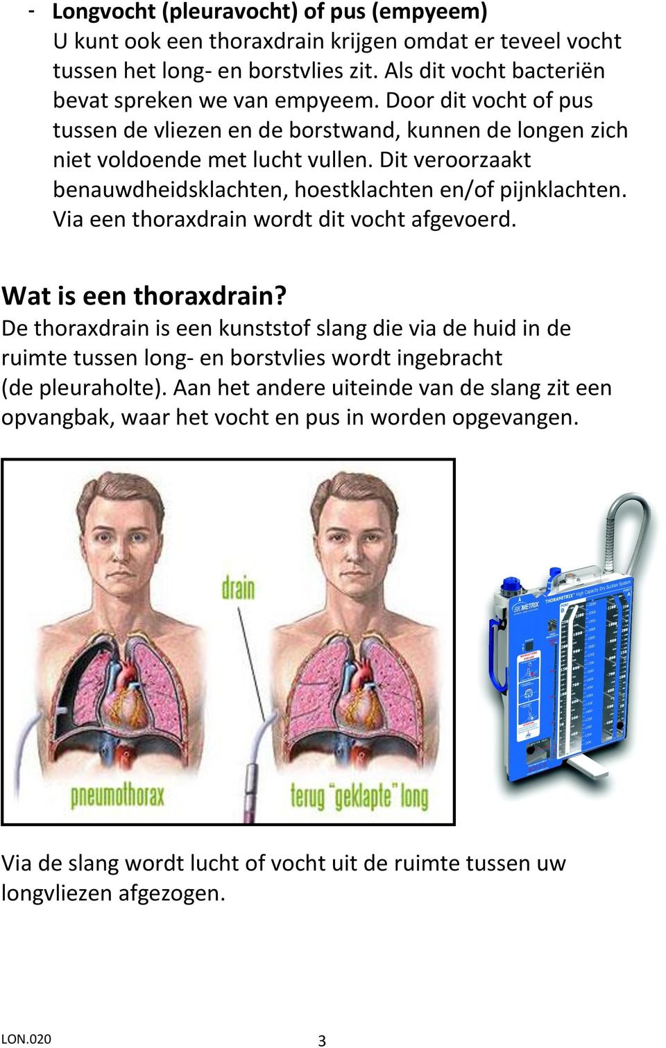 Via een thoraxdrain wordt dit vocht afgevoerd. Wat is een thoraxdrain?