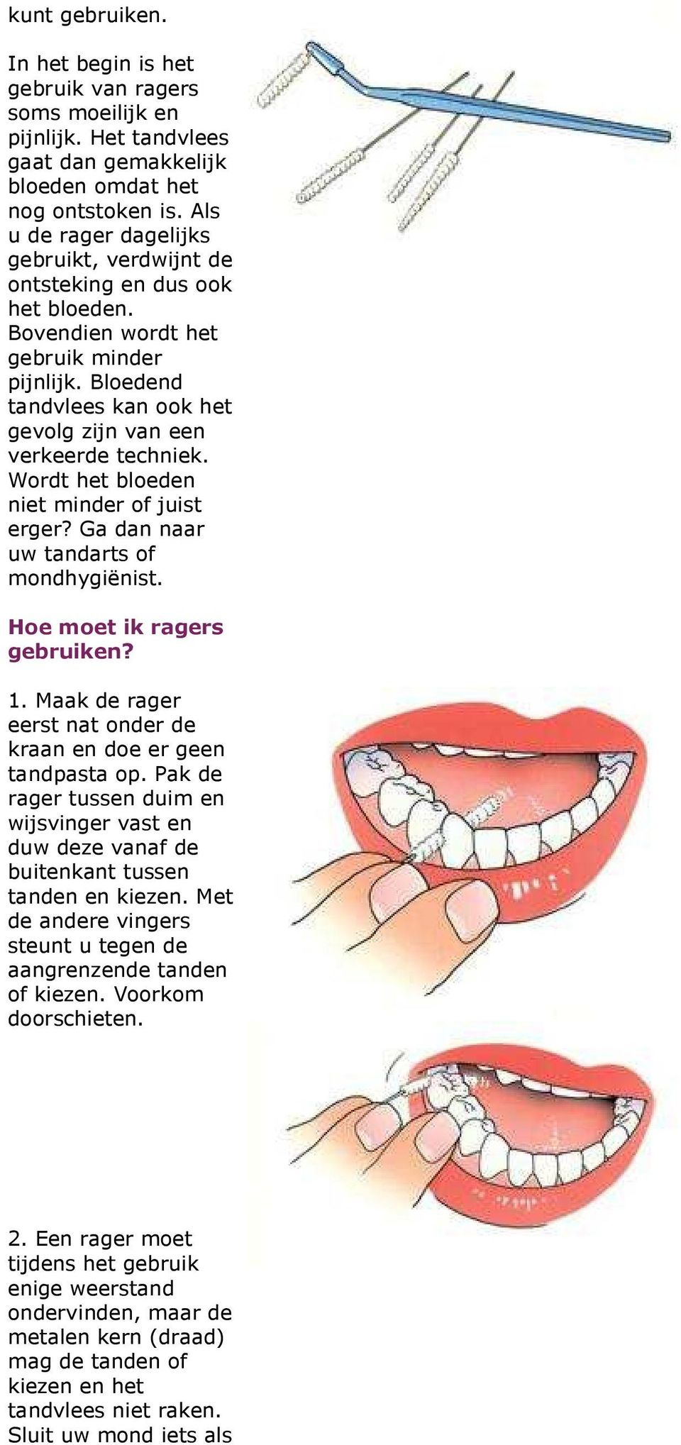 Wordt het bloeden niet minder of juist erger? Ga dan naar uw tandarts of mondhygiënist. Hoe moet ik ragers gebruiken? 1. Maak de rager eerst nat onder de kraan en doe er geen tandpasta op.