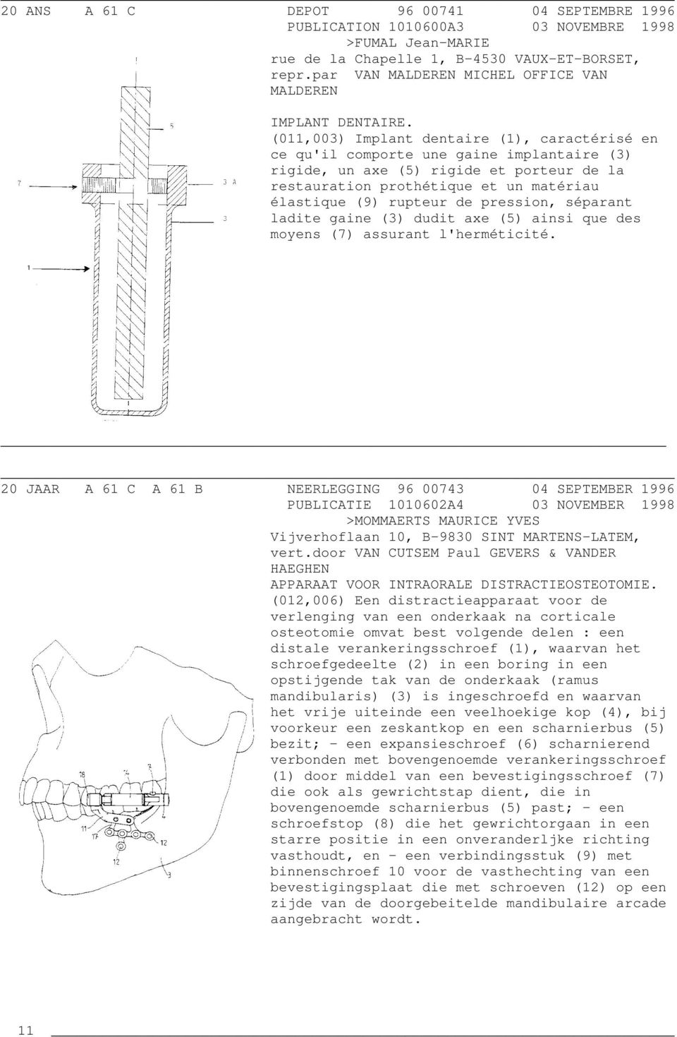 (011,003) Implant dentaire (1), caractérisé en ce qu'il comporte une gaine implantaire (3) rigide, un axe (5) rigide et porteur de la restauration prothétique et un matériau élastique (9) rupteur de