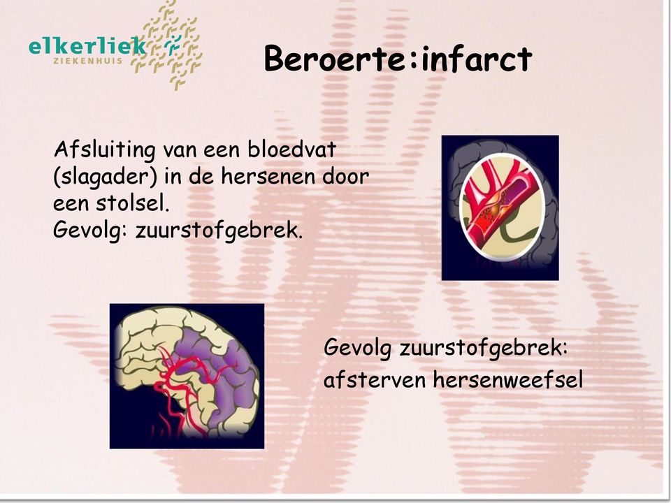 een stolsel. Gevolg: zuurstofgebrek.