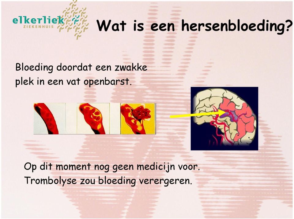 een vat openbarst.