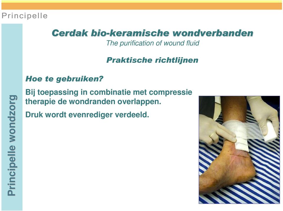 compressie therapie de