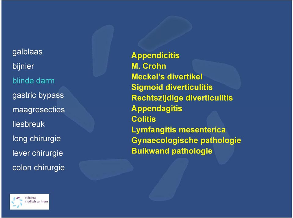 Crohn Meckel s divertikel Sigmoid diverticulitis Rechtszijdige