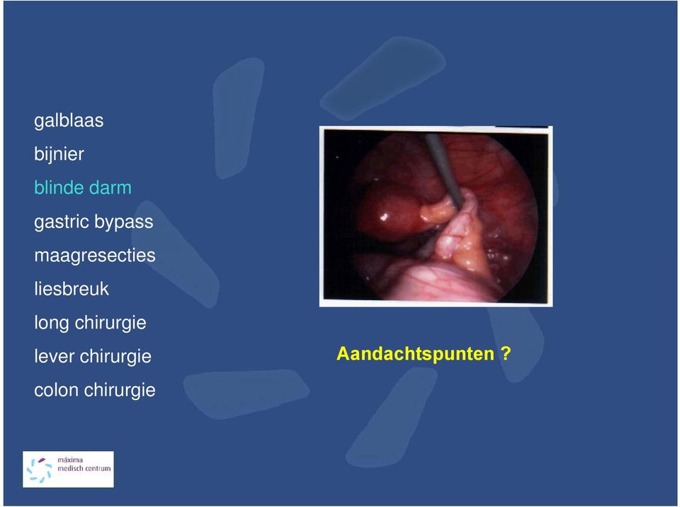 liesbreuk long chirurgie lever