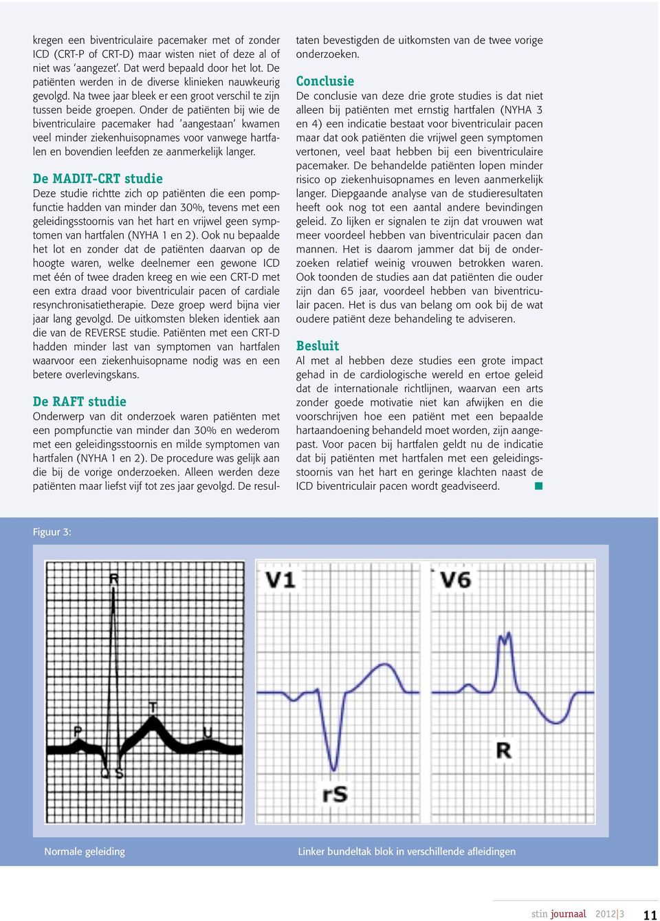 Onder de patiënten bij wie de biventriculaire pacemaker had aangestaan kwamen veel minder ziekenhuisopnames voor vanwege hartfalen en bovendien leefden ze aanmerkelijk langer.