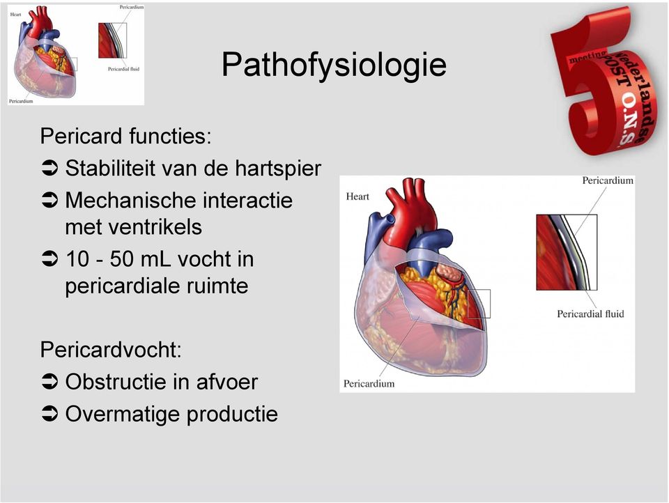 ventrikels 10-50 ml vocht in pericardiale ruimte