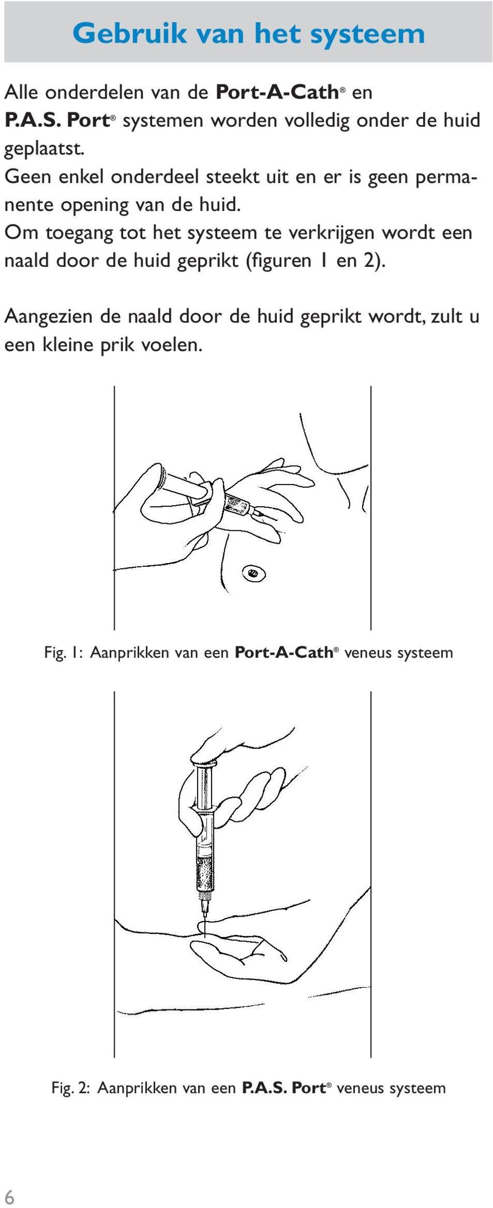 Geen enkel onderdeel steekt uit en er is geen permanente opening van de huid.