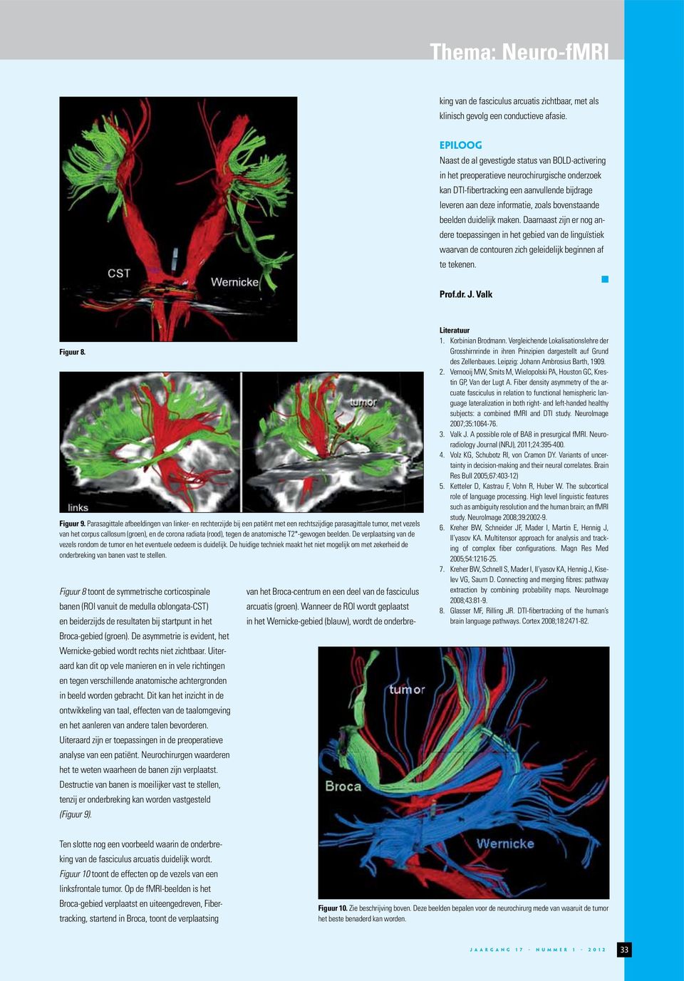 Epiloog Naast de al gevestigde status van BOLD-activering in het preoperatieve neurochirurgische onderzoek kan DTI-fibertracking een aanvullende bijdrage leveren aan deze informatie, zoals