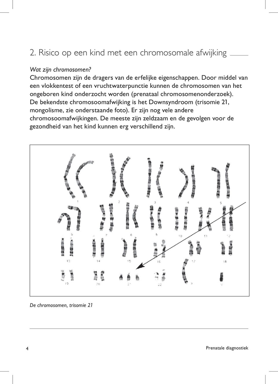 chromosomenonderzoek). De bekendste chromosoomafwijking is het Downsyndroom (trisomie 21, mongolisme, zie onderstaande foto).