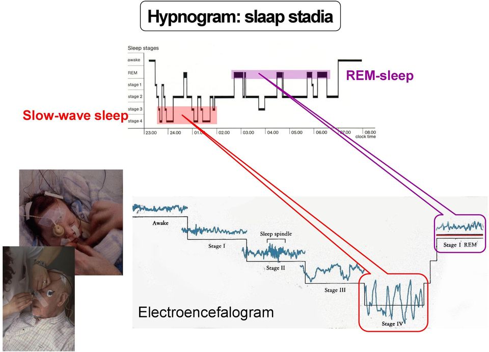 Slow-wave sleep