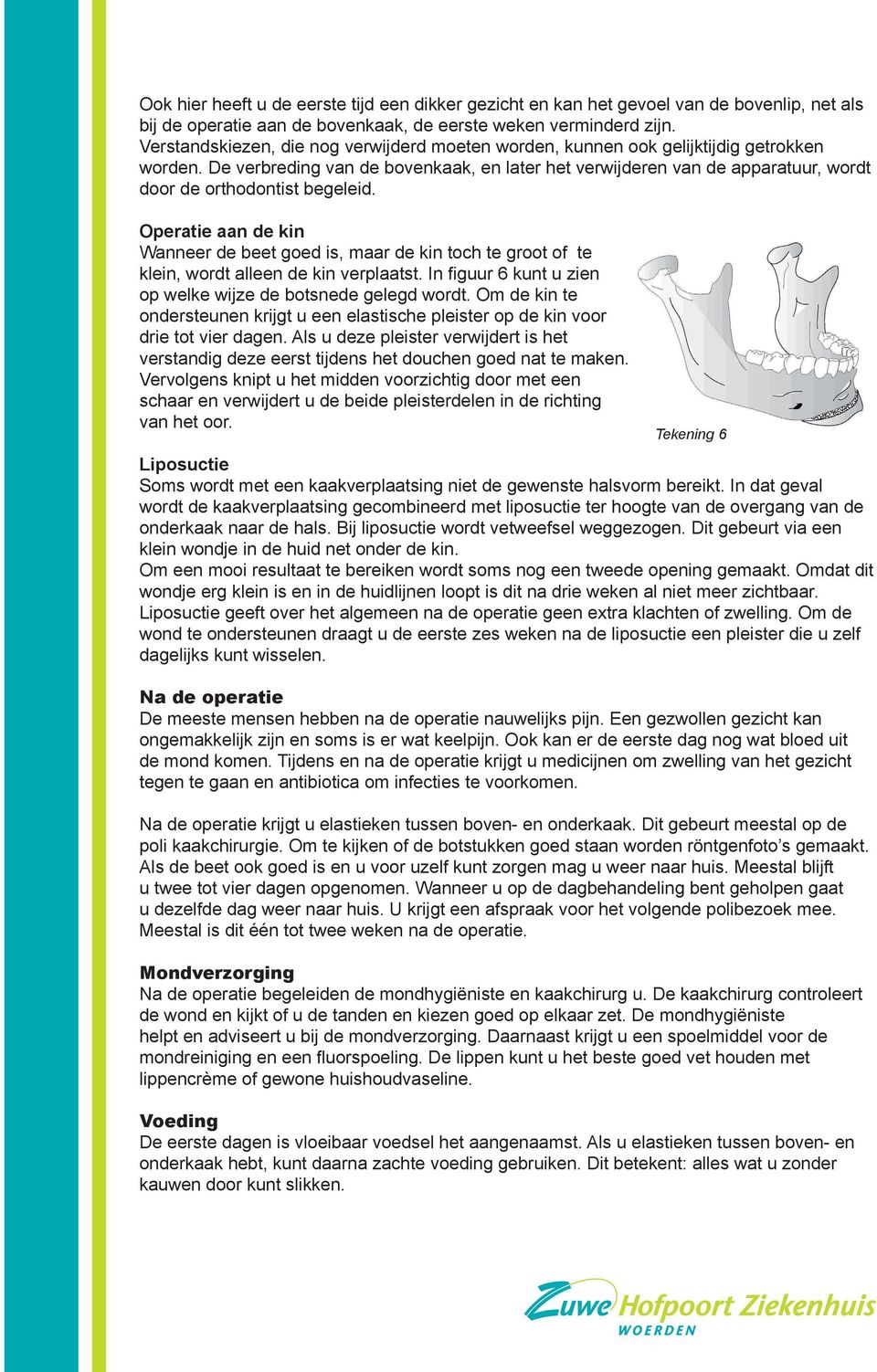 De verbreding van de bovenkaak, en later het verwijderen van de apparatuur, wordt door de orthodontist begeleid.