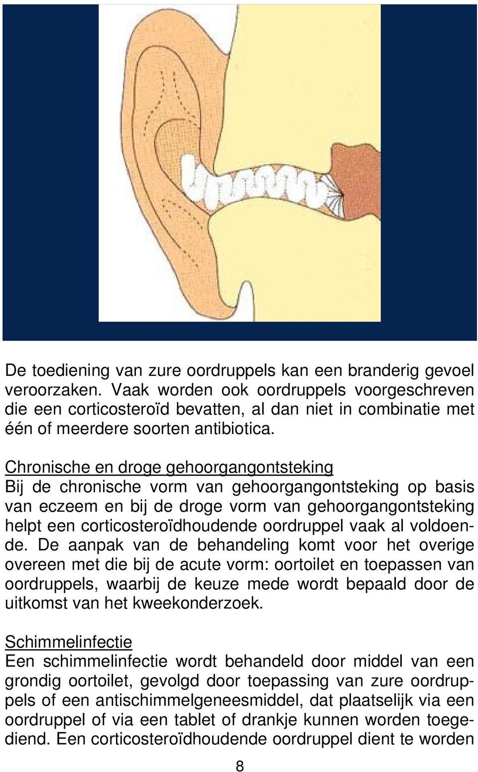 Chronische en droge gehoorgangontsteking Bij de chronische vorm van gehoorgangontsteking op basis van eczeem en bij de droge vorm van gehoorgangontsteking helpt een corticosteroïdhoudende oordruppel