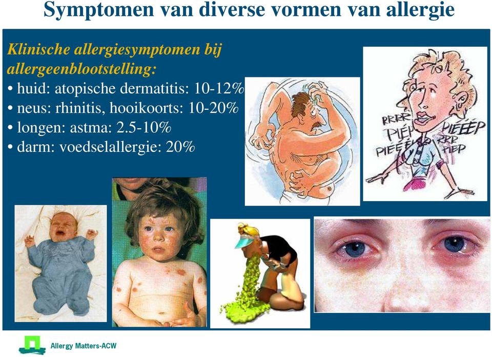 atopische dermatitis: 10-12% neus: rhinitis,