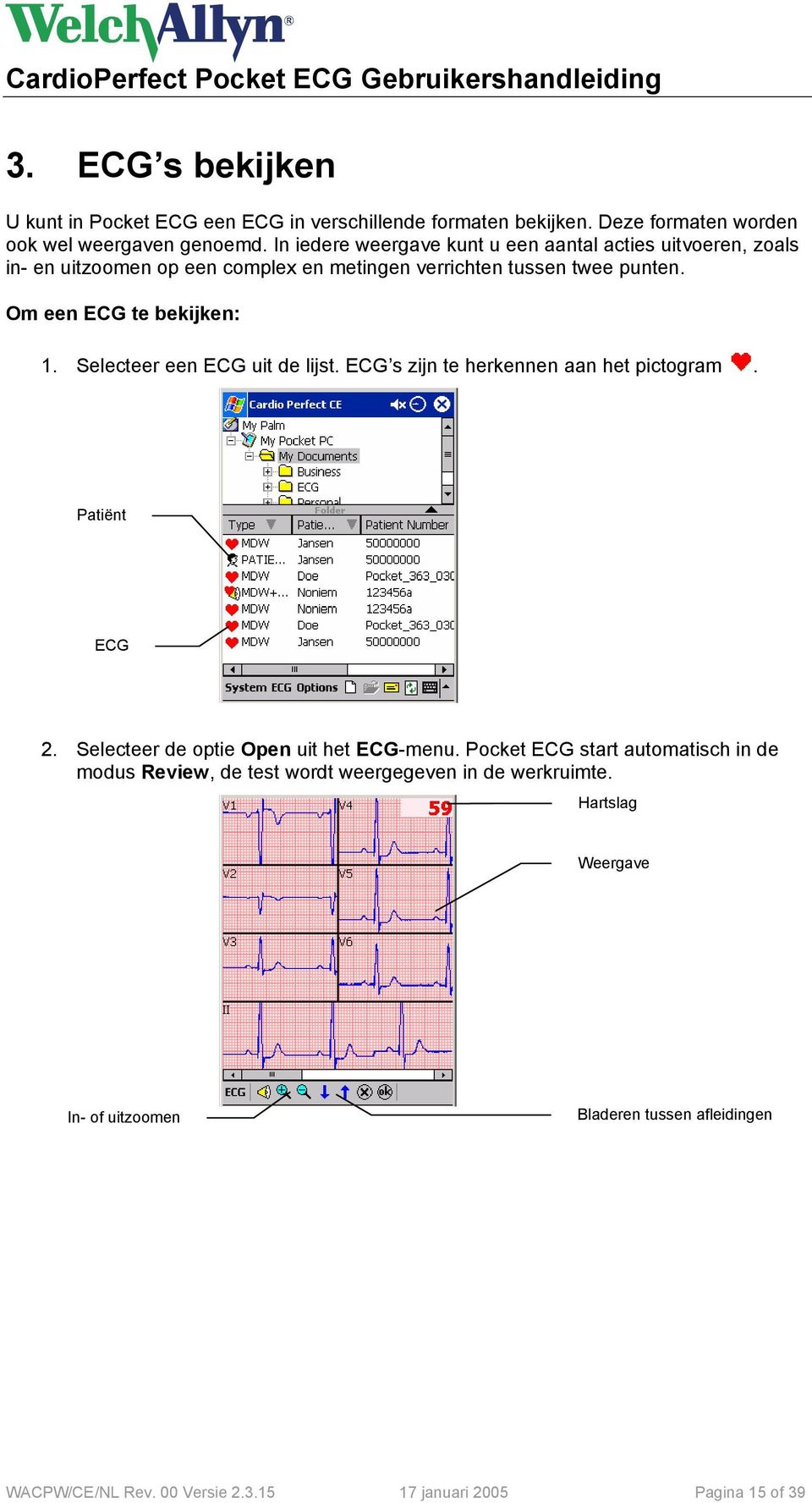 Selecteer een ECG uit de lijst. ECG s zijn te herkennen aan het pictogram. Patiënt ECG 2. Selecteer de optie Open uit het ECG-menu.