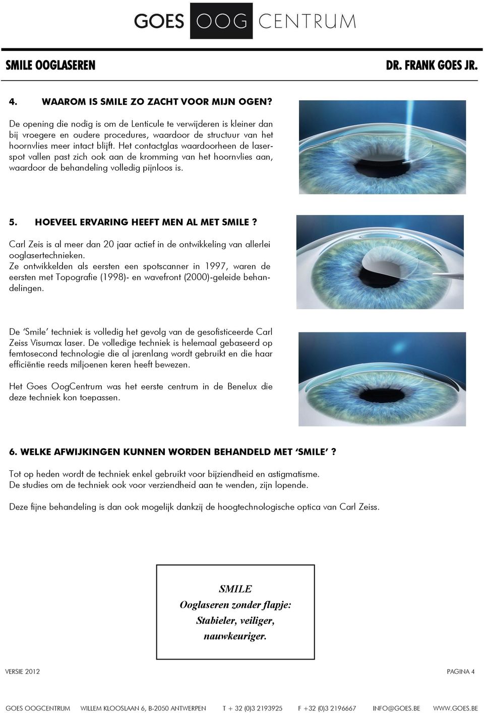 Het contactglas waardoorheen de laserspot vallen past zich ook aan de kromming van het hoornvlies aan, waardoor de behandeling volledig pijnloos is. 5. HOEVEEL ERVARING HEEFT MEN AL MET SMILE?