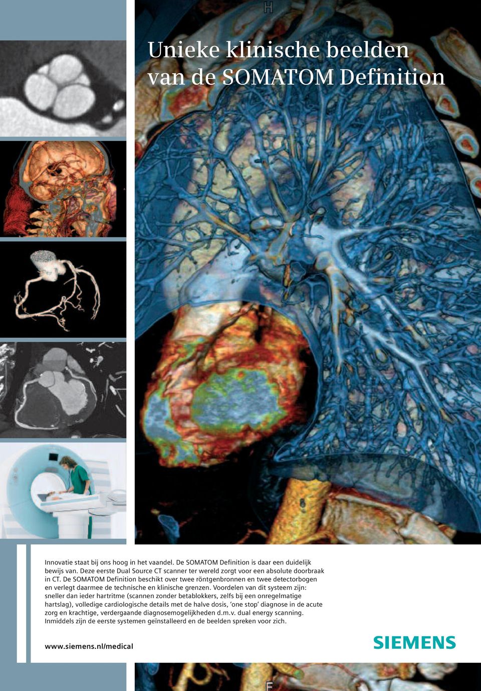 De SOMATOM Definition beschikt over twee röntgenbronnen en twee detectorbogen en verlegt daarmee de technische en klinische grenzen.