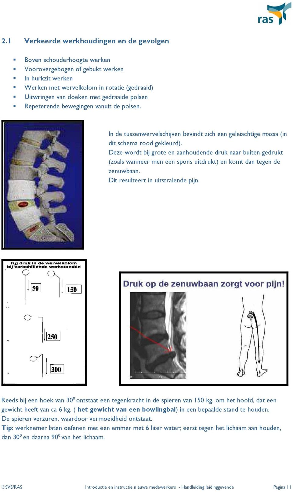 Deze wordt bij grote en aanhoudende druk naar buiten gedrukt (zoals wanneer men een spons uitdrukt) en komt dan tegen de zenuwbaan. Dit resulteert in uitstralende pijn.