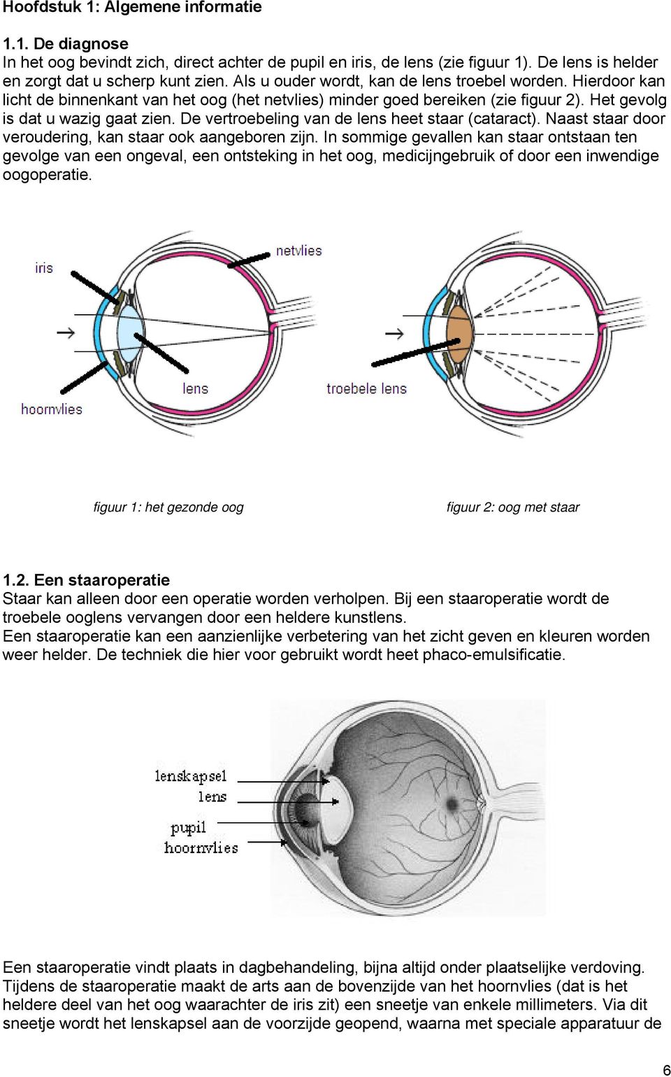 De vertroebeling van de lens heet staar (cataract). Naast staar door veroudering, kan staar ook aangeboren zijn.