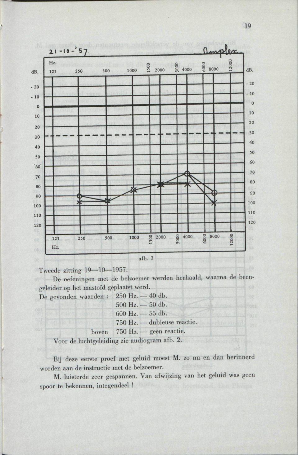 De gevonden waarden : 250 Hz. 40 db. 500 Hz. 50 db. 600 Hz. 55 db. 750 Hz. dubieuse reactie, boven 750 Hz. geen reactie.